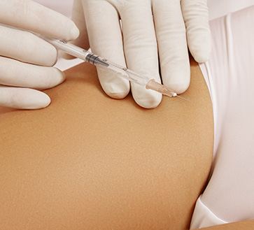 REJUVENECIMIENTO VAGINAL